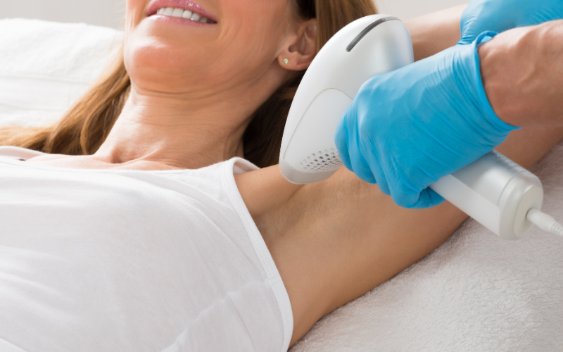 Woman having her underarm hair removed