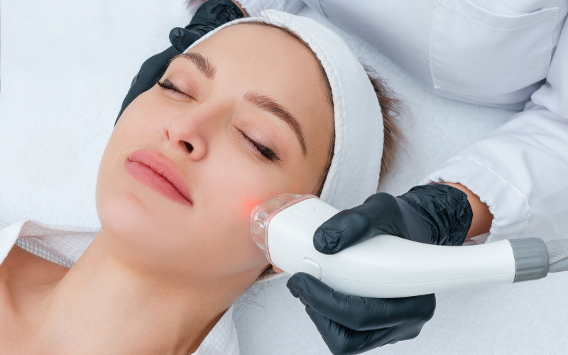 Woman receiving a laser skin resurfacing service
