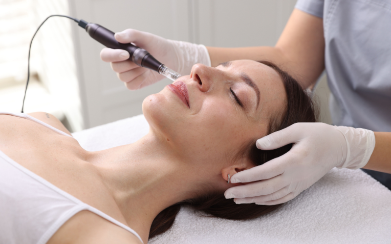 Woman receiving microneedling