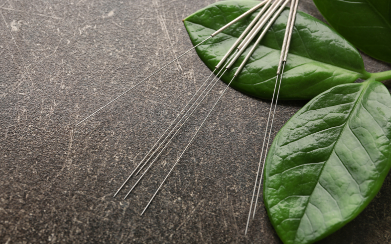 Acupuncture needles