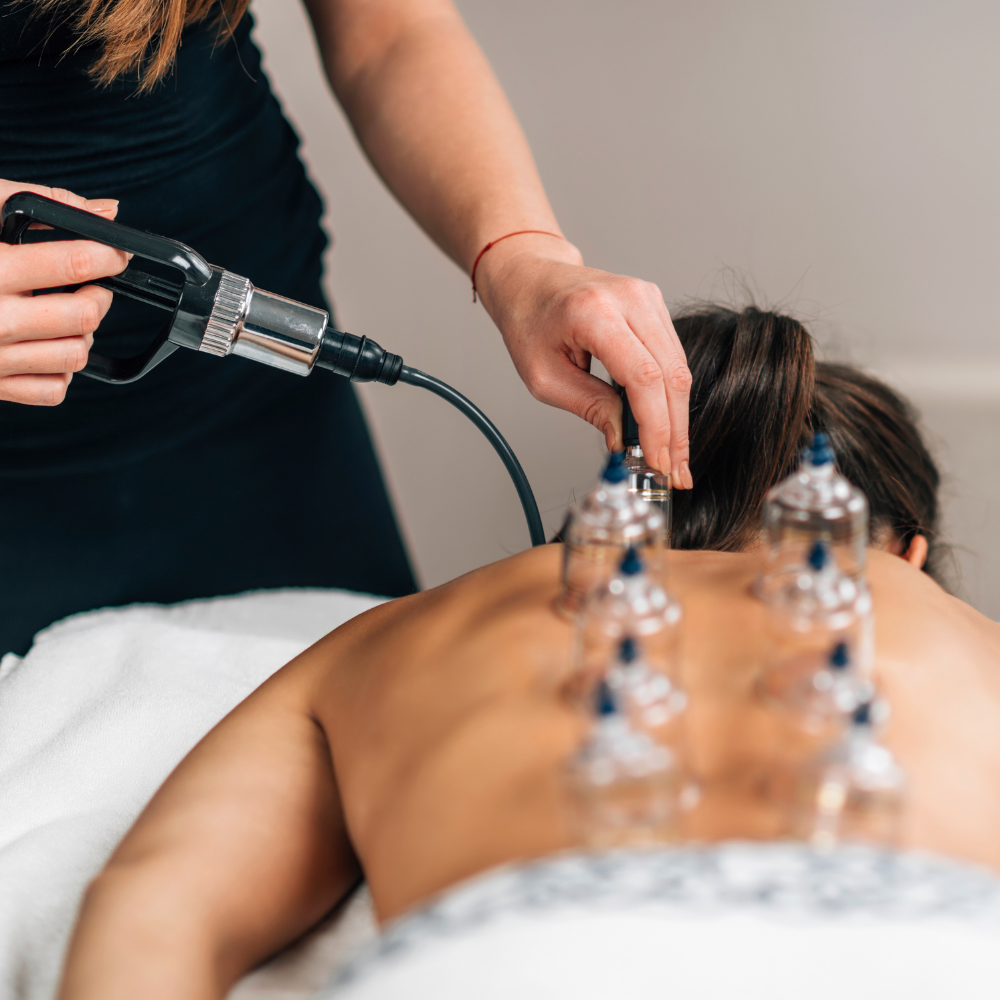 Woman receiving cupping therapy